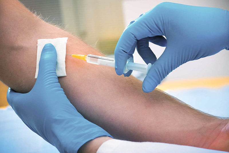 TB skin and blood test in Toronto